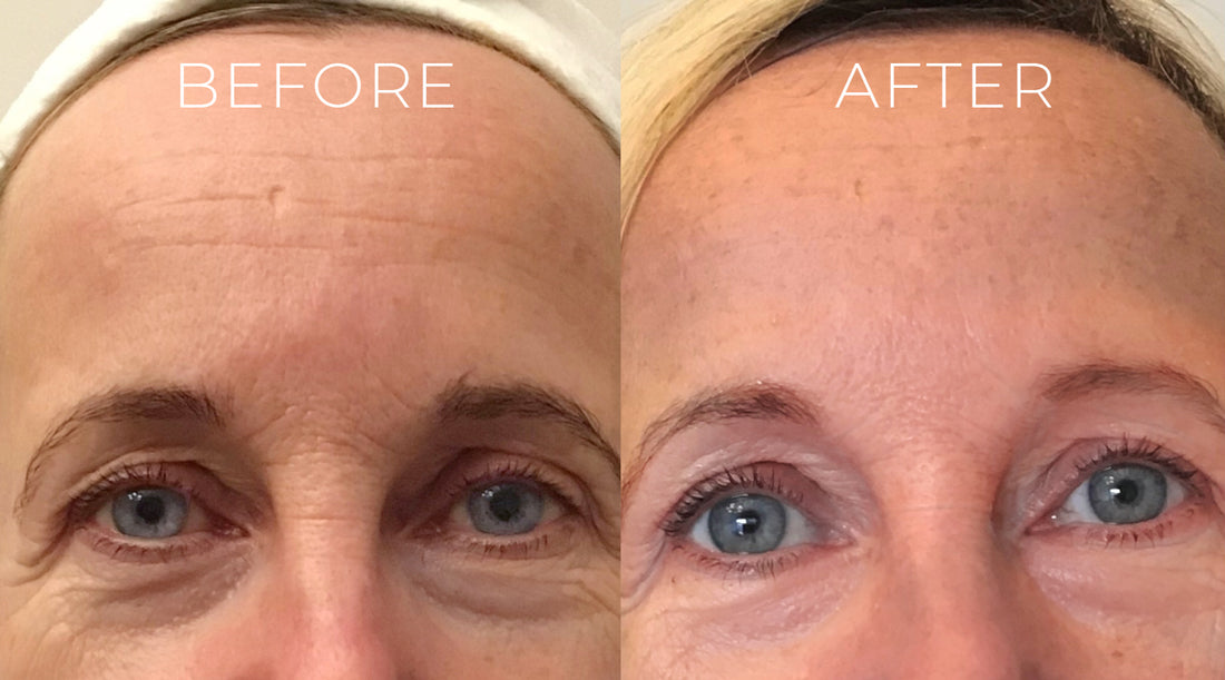 Buy 1, Get 1 FREE Marine Collagen Original Time Reverse Serum