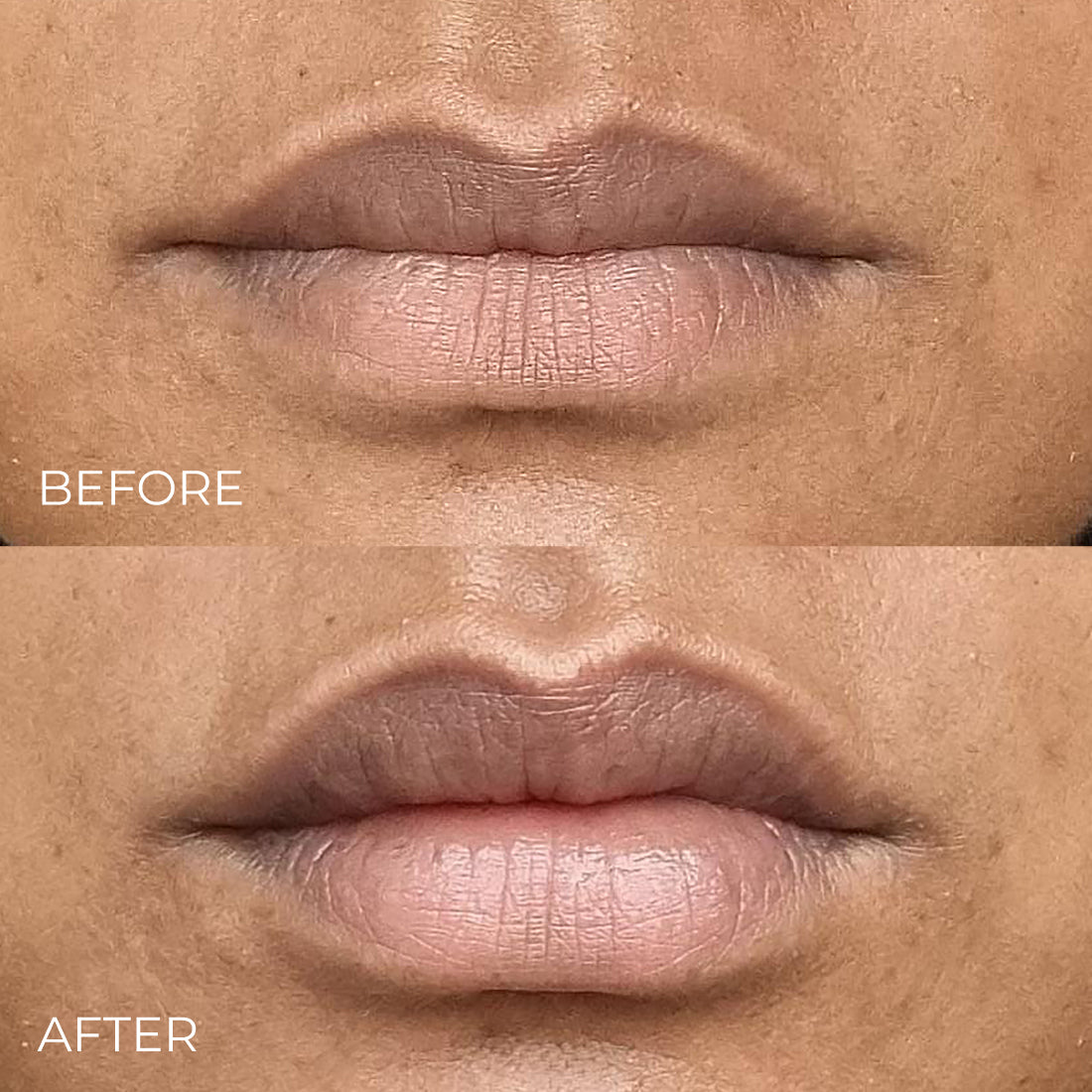 Instant Lip Enhancer