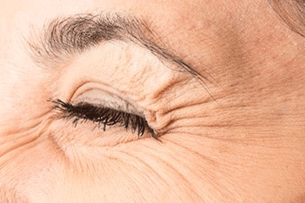 Eye Care Blog
