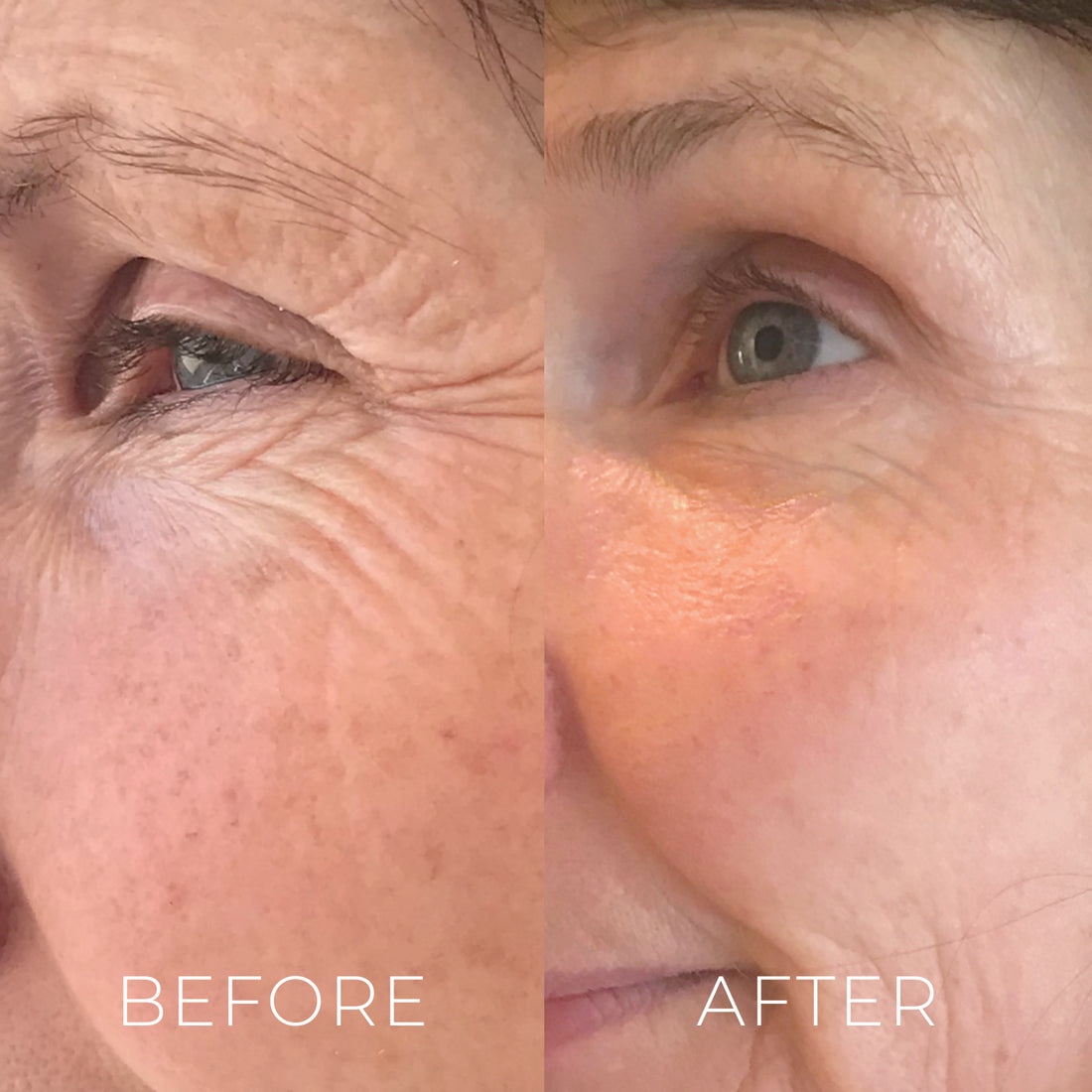 Marine Collagen SPF 50 & Instant Eye Hydration Treatment